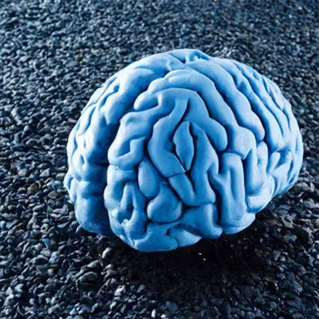 Сотрясение головного мозга в лобной …» — создано в Шедевруме